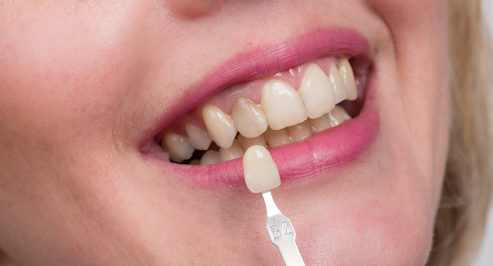 Zahnbehandlung und Zahnkliniken in Istanbul